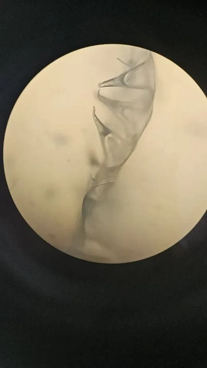 Укола не&nbsp;будет: ученые БФУ создают «умные» пластыри для&nbsp;будущего медицины |  3