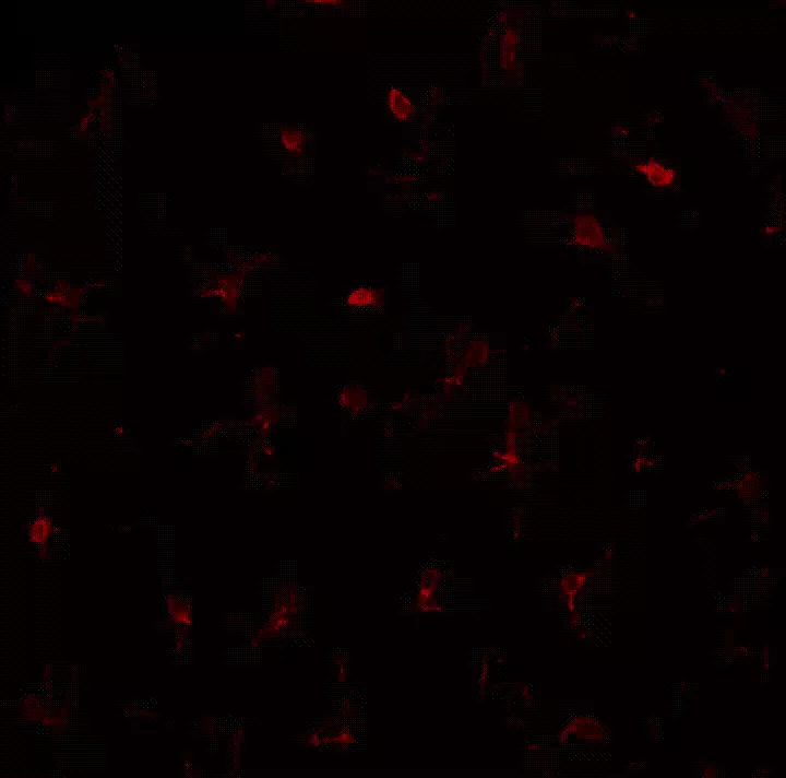 Клетки микроглии animation.gif