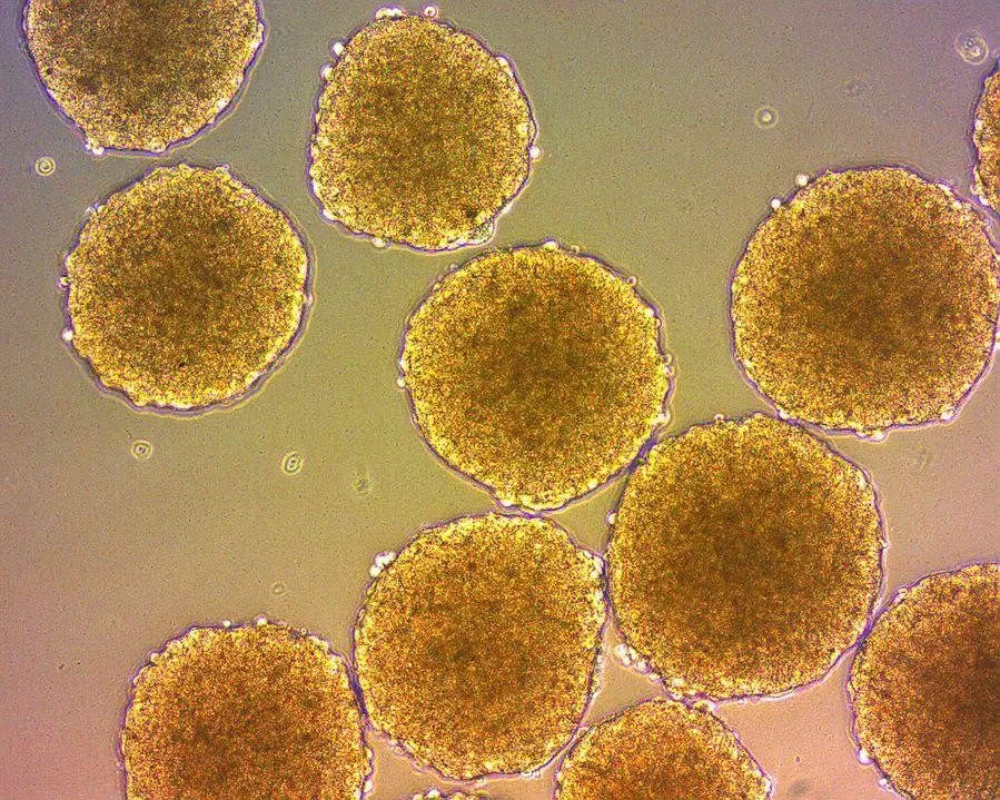 Сфероиды 3.jpg