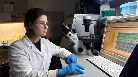 Стартап ученых БФУ по лечению эндометриоза наночастицами  в акселераторе SechenovTech