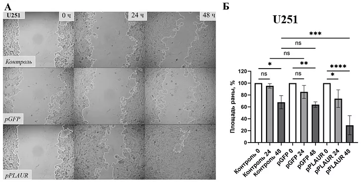 Найдена причина агрессивности опухолей головного мозга |  1