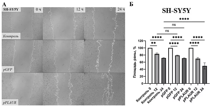 Найдена причина агрессивности опухолей головного мозга |  3
