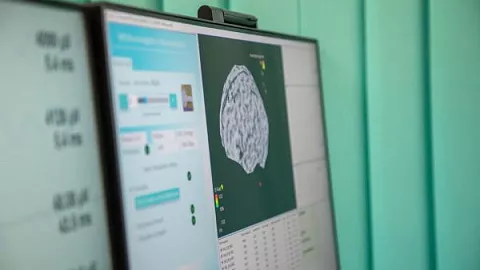 Ученые БФУ разрабатывают новые методы диагностики эпилепсии