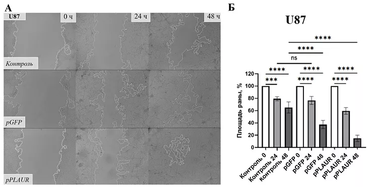 Найдена причина агрессивности опухолей головного мозга |  2